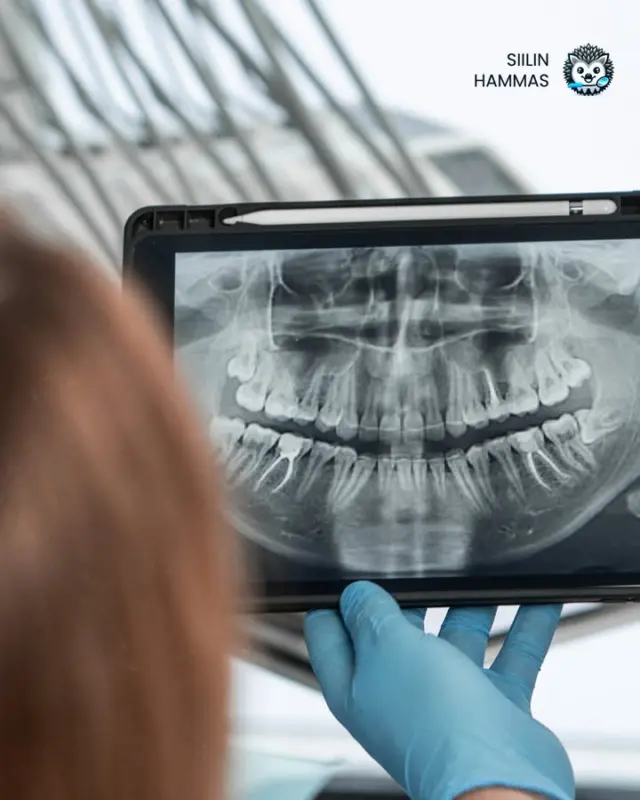 Hampaiden ja ikenien kunto vaikuttaa laajasti koko kehon hyvinvointiin. Siksi tutkimme tarkastuksessa aina myös limakalvot, kielen, purennan ja leukanivelen toiminnan. Tarvittaessa otamme röntgenkuvat, jotta saat tarkan kokonaiskuvan suusi terveydestä.

😊 Me huolehdimme hymystäsi luotettavasti ja asiantuntevasti.

#hammaslääkäri #hammashoito #siilinjärvi #kuopio #hymy #hampaat